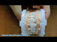 Corona de zirconia con joyas