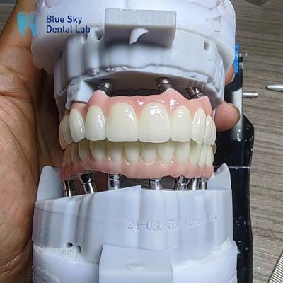 comprar Implante de zirconia en capas Personalización Casos de implantes de arco completo online manufacture