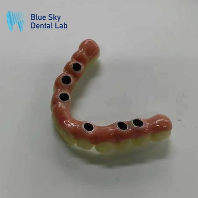 comprar Esterilización Esterilización por vapor Casos de implante con compatibilidad universal online manufacture