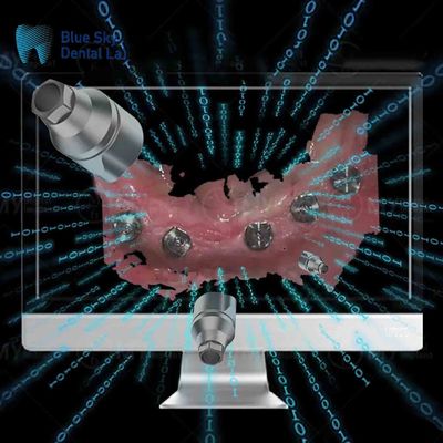 comprar Cuerpos de exploración directa de implantes reutilizables en un solo cuerpo de exploración dental online manufacture
