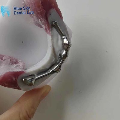 comprar Barra de titanio dental personalizable con dientes de abutment para prótesis dental online manufacture