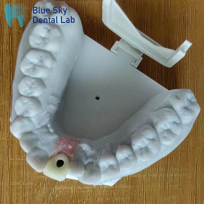 comprar Esterilización por vapor Corona de implante único Corona de implante dental de superficie lisa online manufacture