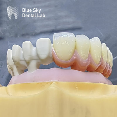 comprar Personaliza los casos de implantes de color con diseño natural de superficie lisa para la compatibilidad universal online manufacture