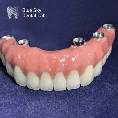comprar Casillas de implantes rectangulares autoclavables universales Superficie lisa Color plateado online manufacture