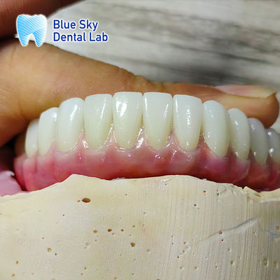 comprar Compatibilidad universal Envases para implantes personalizados Envases para implantes de boca completa online manufacture