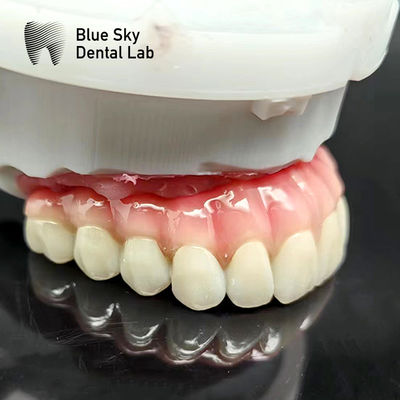comprar Casco de implante bucal completo personalizado Compatibilidad universal online manufacture