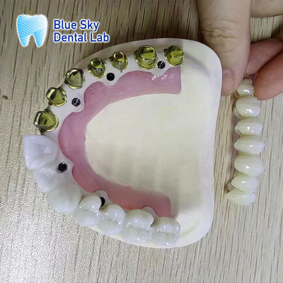 comprar Cuadro de metal de titanio puro de oro plateado de oro dental Cuadro de metal de oro plateado parcial online manufacture