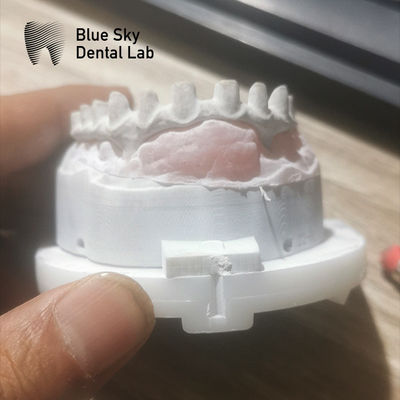comprar Puente de malos industriales personalizables en plata y oro Puente de malos implantes online manufacture