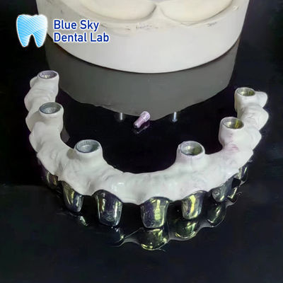 comprar Puente Malo de titanio puro Dentes de marco de metal de plata personalizables online manufacture