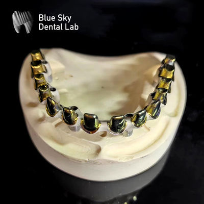 comprar Puente de oro puro de titanio Malo Cuadro de metal Puente de implantes Malo online manufacture