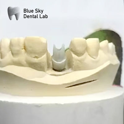 comprar Implante de abutment de zirconia estética biocompatible de precisión fresada online manufacture