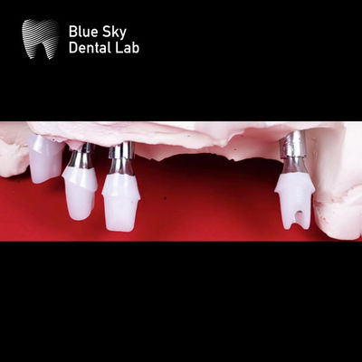 comprar Implantes dentales de cerámica de zircónia, fresados con precisión online manufacture