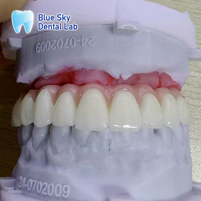 comprar Personaliza el color de las cajas de instrumentos de implantación de superficie lisa online manufacture
