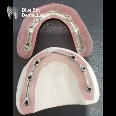 comprar Barra de titanio dental con dentadura de acrílico completo Barra de titanio para implantes dentales online manufacture