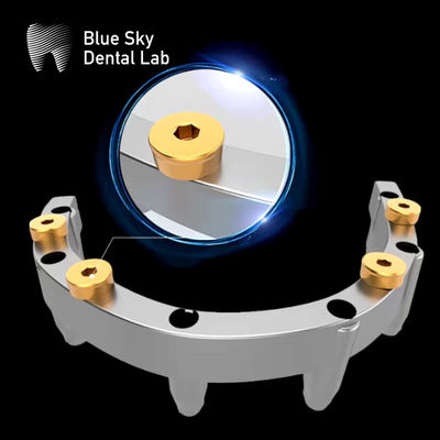 comprar Apego extraíble de localizador con implantes de dentadura de titanio con dentadura de localizador superior online manufacture