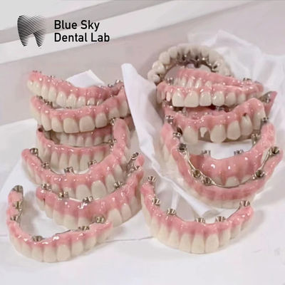 comprar Casos de implantes de cielo azul con puente de marco malo de titanio puro online manufacture