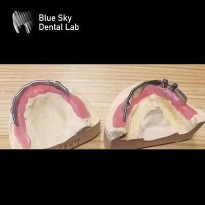 comprar Implantes dentales azul cielo barra de titanio de plata para implantes dentales online manufacture
