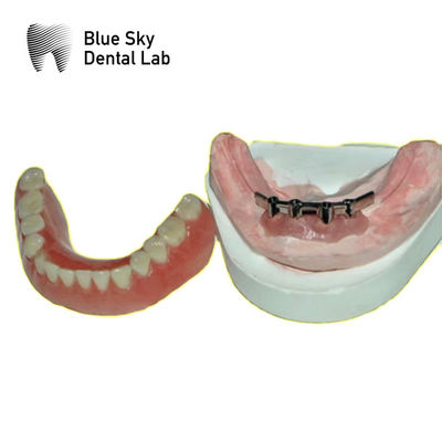 comprar Barras de titanio dentales extraíbles para dentaduras azul cielo online manufacture