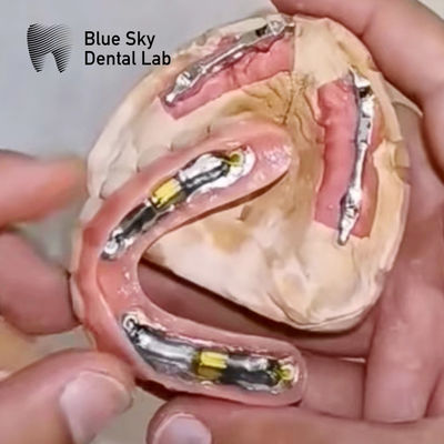 comprar Implantes dentales Blue Sky con barra de titanio para prótesis extraíbles online manufacture