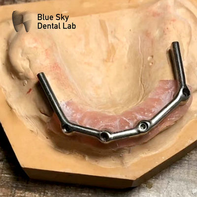 comprar Implante dental de titanio para la boca completa online manufacture