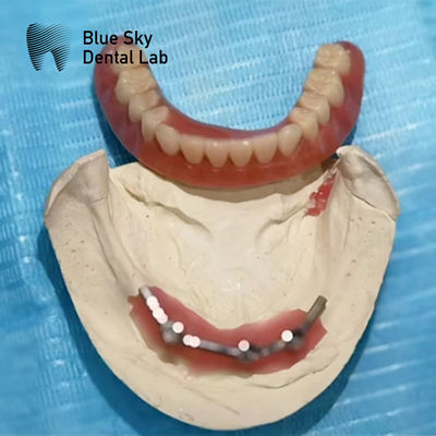 comprar Implante de titanio de barra azul para dentadura de implantes online manufacture