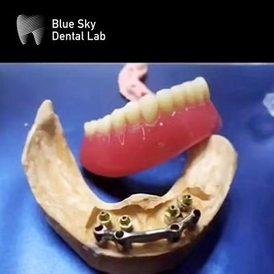 comprar Barras de titanio dentales de boca completa Restauración de dentadura extraíble precisa online manufacture