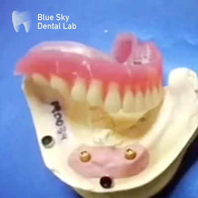 comprar Localizador dental de titanio con dentadura extraíble y conexiones con tapa de bola online manufacture