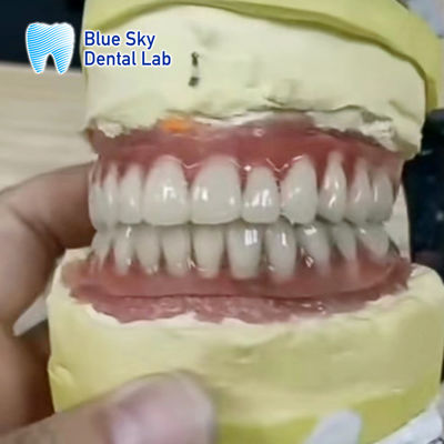 comprar Implantes dentales de barra de titanio superior e inferior online manufacture