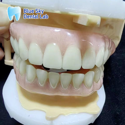comprar Dentadura parcial de acrílico temporal de color azulado y azul completa Dentadura de acrílico superior e inferior online manufacture