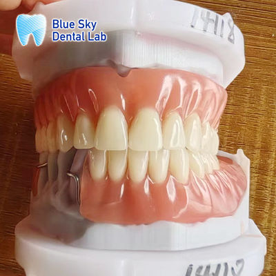 comprar Dentadura parcial extraíble de acrílico de resina con cerraduras y dentadura completa de acrílico online manufacture