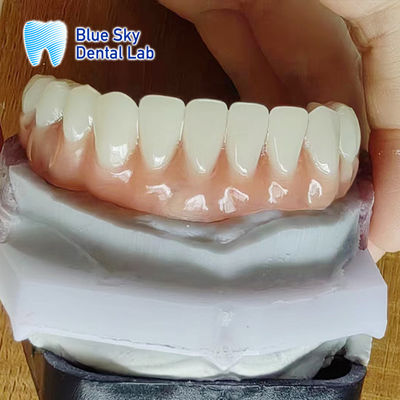 comprar Dentadura de resina de acrílico de aspecto natural online manufacture