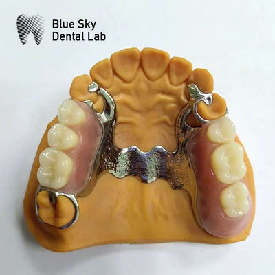 comprar Dental molde de dentadura parcial marco de dentadura parcial que parecen reales online manufacture