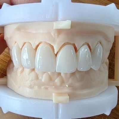 comprar Estética natural Puente de corona de zirconia en capas para una sonrisa hermosa y una buena restauración Certificación FDA y CE online manufacture