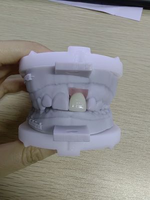 comprar Casos de implantes de alta durabilidad que contienen hasta 5 implantes para flexibilidad de prótesis extraíble online manufacture