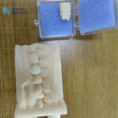Estética Restauración dental de zirconia Coronas de porcelana de zirconia