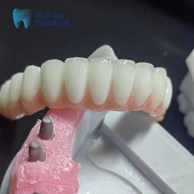 Cuerpo de implantes dentales de zirconia personalizado