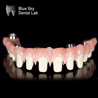 Sistema de implantes dentales de titanio puro de puente Malo de cielo azul personalizable