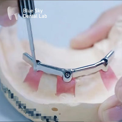 Barras de titanio de precisión dental con accesorios preciosos biocompatibles