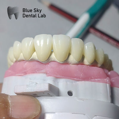 Cuerpo de implantes dentales universales compatibles con múltiples sistemas de implantes