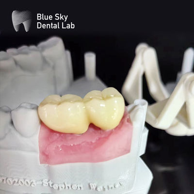 Casos para implantes de superficie lisa Esterilización al vapor Casos para implantes dentales