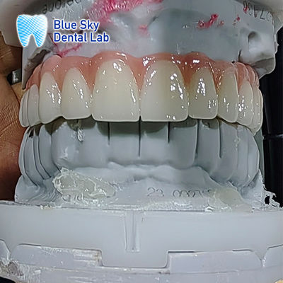 Cuadro de implante dental artificial Cuadro de implante de esterilización múltiple