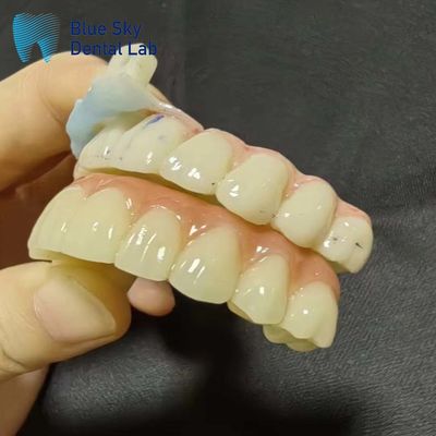 Casos de implantación Casos de implantación artificial para la compatibilidad del sistema sin fisuras
