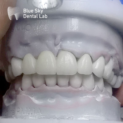 Dentes de zirconia rectangulares de capas múltiples antes del acristalamiento