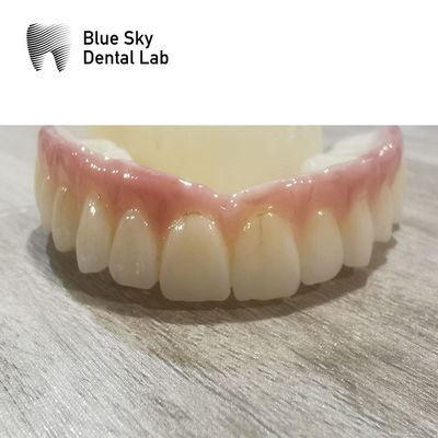 Compatibilidad Envases de implantes Envases dentales del sistema de implantes regulares