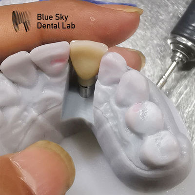 Estudios de biocompatibilidad Escenarios de implantación Esterilización por vapor