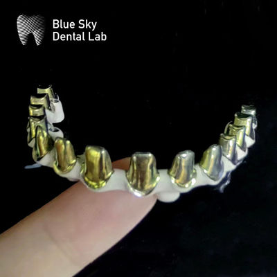 Plata Oro Universal Titanio puro Marco de metal Dental personalizable