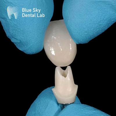 Escaneo oral Abutment de zirconio personalizado Abutments de zirconio de alta resistencia