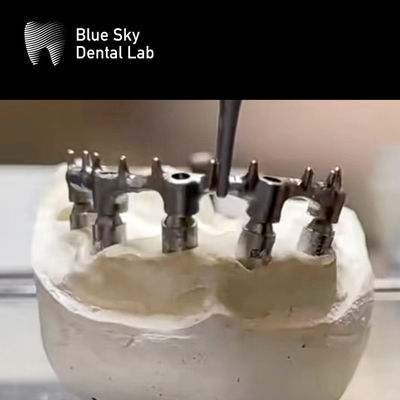 Prótesis extraíble Bar de titanio dental con uñas