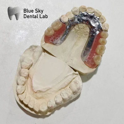 Cuadro de metal de dentadura ajustable Dentes de resina Rpd Cuadro de metal