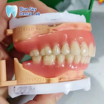Dentadura extraíble de acrílico de arco completo Dentadura de aspecto natural personalizable